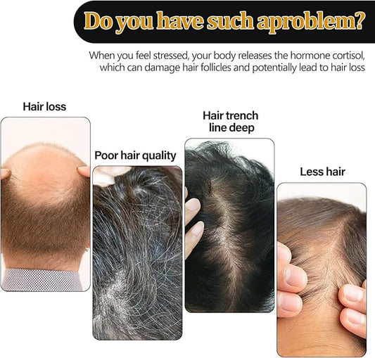 Eelhoe Hair Regrowth Shampoo