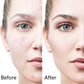 6-in-1 Microneedling Derma Roller Kit