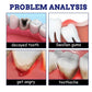 Tooth Pain Relief Spray