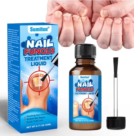Sumifun – Anti Fungal Nail Repair Solution (Original)