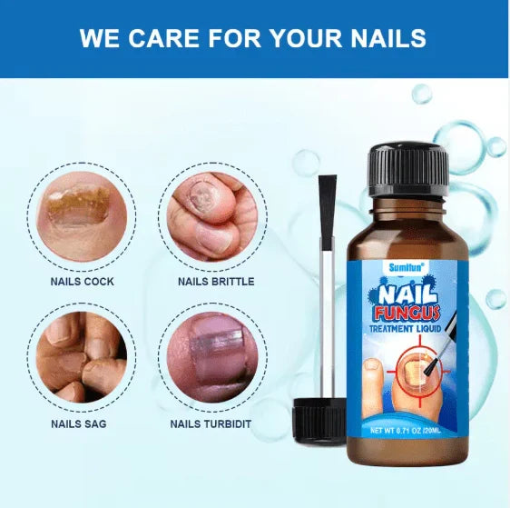 Sumifun – Anti Fungal Nail Repair Solution (Original)