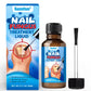 Sumifun – Anti Fungal Nail Repair Solution (Original)