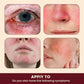 Sumifun Rosacea Relief Cream
