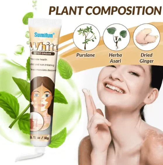 Sumifun Vitiligo Treatment Cream