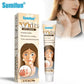 Sumifun Vitiligo Treatment Cream